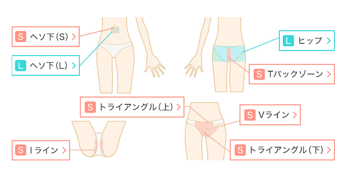 ジェイエステティック　VIO脱毛